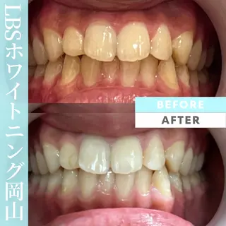 LBSホワイトニング 🌐岡山店のその他イメージ