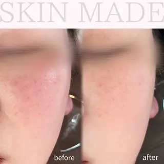 abbellina×uno所属・Anna / 出雲・肌質改善のエステ・リラクイメージ