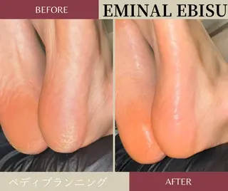 EMINAL恵比寿 HITOMIのエステ・リラクイメージ