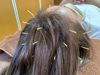 美容鍼・脱毛サロン CURAIMのエステ・リラクイメージ