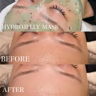 ツキイチ肌管理 ivy careのエステ・リラクイメージ