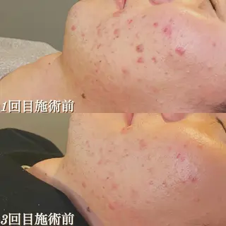 美容鍼灸師 川口 愛華のエステ・リラクイメージ