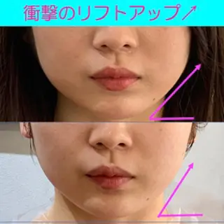 小顔美肌&痩身ｻﾛﾝ My Timeのエステ・リラクイメージ