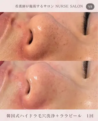 美肌・小顔専門🪄 看護師施術/松﨑のエステ・リラクイメージ