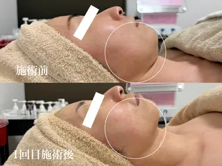 フェイシャルサロンKey of Face所属・村上 貴子のエステ・リラクイメージ