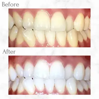 エクシア天神店 💟marinのその他イメージ