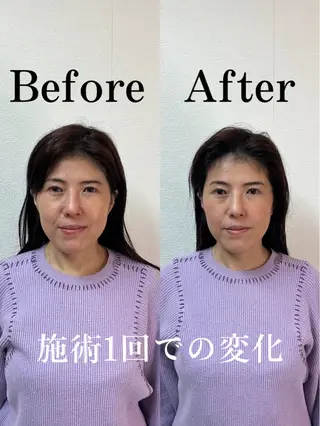 顔の整体 Nefert【ネフェルト】所属・こやま りょうのエステ・リラクイメージ