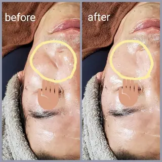 ドライヘッド&美肌 Amourのエステ・リラクイメージ