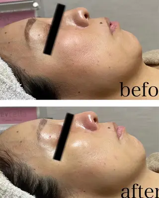 ビューティーサロン B.glossyのネイルデザイン