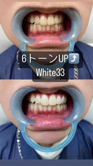 メンズ セルフホワイトニング White33大名のその他イメージ