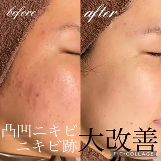 Ensor Clair所属・EnsorClair 代表　野口真央のエステ・リラクイメージ