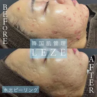 Lilyboo 池袋のエステ・リラクイメージ