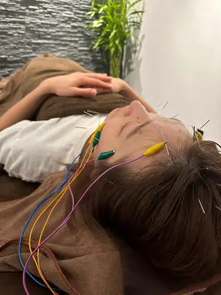 小顔矯/美容鍼/鍼灸 BeauJuのその他イメージ