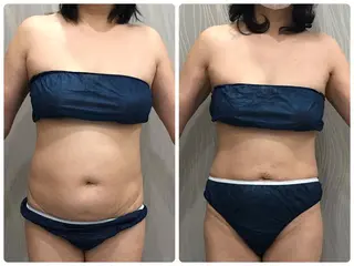 エステティックサロン ベルネのエステ・リラクイメージ