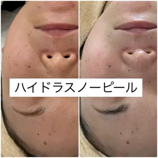 肌質管理専門店 Lé pia　AMIのエステ・リラクイメージ