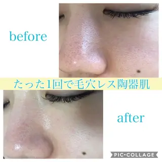 ロング カラー パーマ ヘアアレンジ キッズ ネイル マツエク・マツパ EnsorClair 代表 野口真央のエステ・リラクイメージ