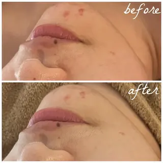 メンズ メナード岐阜市茜部 杉浦のエステ・リラクイメージ