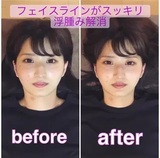 ブライダルエステ 美容整体・筋膜オイルのエステ・リラクイメージ