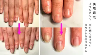 ネイル 深爪矯正専門店 ネイルサロンKUUのネイルデザイン