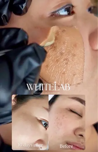 M渋谷店所属・M渋谷 ホワイトニングのエステ・リラクイメージ