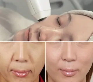 顔脱毛＆毛穴＆ニキビ 優良№1♪ヒロコ♪のエステ・リラクイメージ