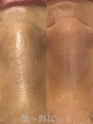 うえつま ふみえのエステ・リラクイメージ