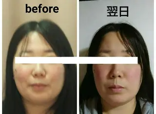 小顔 美肌専門 Matoriaのエステ・リラクイメージ