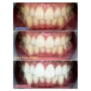 M渋谷 ホワイトニングのエステ・リラクイメージ