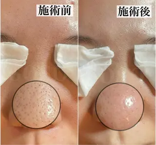 salon soso(ソソ)のエステ・リラクイメージ