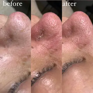 private salon arのマツエク・マツパデザイン