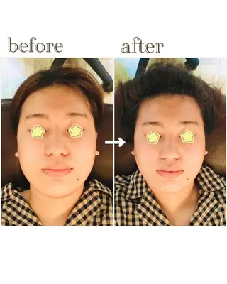 EXTR エクスターのエステ・リラクイメージ