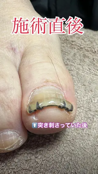 ネイル ○△□ 守口市のネイルデザイン