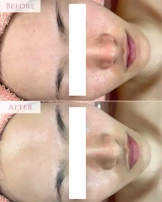 肌質改善専門サロン Bellmi/心斎橋のエステ・リラクイメージ