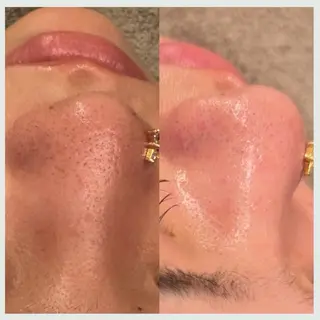 Florence  〜salon de nurse所属・Florence めぐみのエステ・リラクイメージ