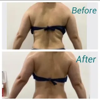 肌質改善サロン★ リュー・ド・ボウテのエステ・リラクイメージ