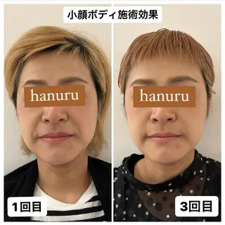 美容整体・小顔矯正 hanuruのエステ・リラクイメージ