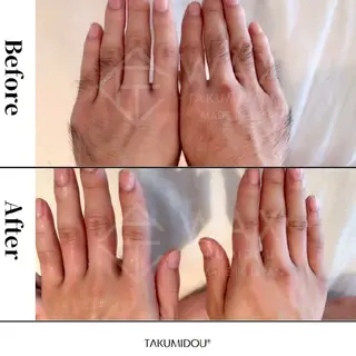 🌙眠れるWAX脱毛 無料モデル募集‼️のエステ・リラクイメージ