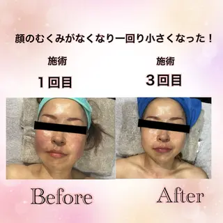 Total Beauty  ラトゥール所属・ラトゥール Maiのエステ・リラクイメージ