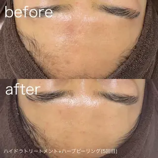 lulularico Yuのエステ・リラクイメージ