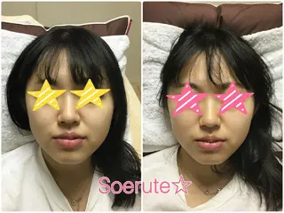 Soerute☆ ソエルテ 井上みえのエステ・リラクイメージ