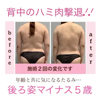 エステサロン JURISのエステ・リラクイメージ