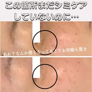 最新シミケアLily de pearlのエステ・リラクイメージ