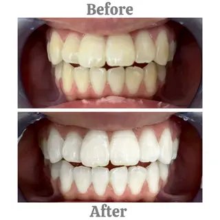 セルフホワイトニング　エクシア相模大野店所属・mo moのその他イメージ