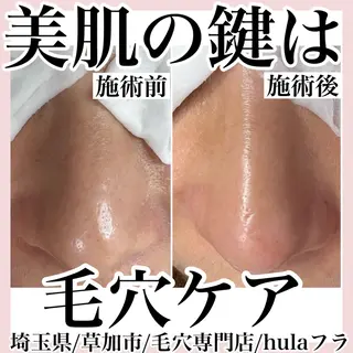 毛穴専門店hula 杉山智美のエステ・リラクイメージ