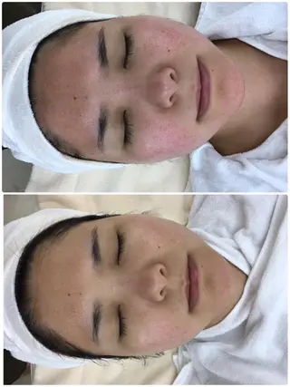 Life Salon別府店のエステ・リラクイメージ