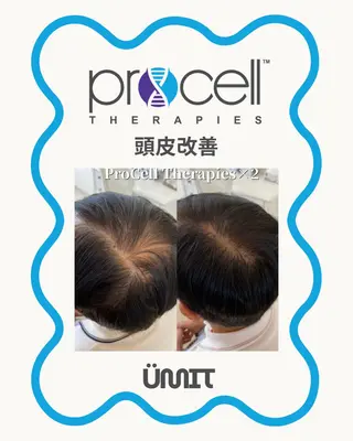 メンズ Ümit(ユミト) プロセルセラピーズのネイルデザイン