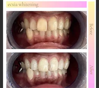 エクシアホワイト長野店所属・セルフホワイトニング エクシア長野店のその他イメージ