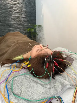 美容鍼灸整体サロンBeauJu所属・小顔矯/美容鍼/鍼灸 BeauJuのその他イメージ