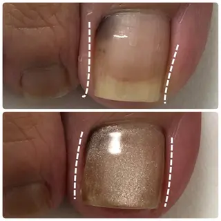 ネイル 自爪育成ネイルケア Lena  nailのネイルデザイン