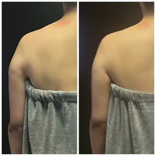 頭痛肩こり改善/小顔 サロンB&H心斎橋の眉毛・アイブロウイメージ